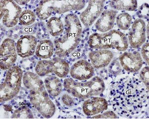 Anti-Aquaporin 1 Antibody