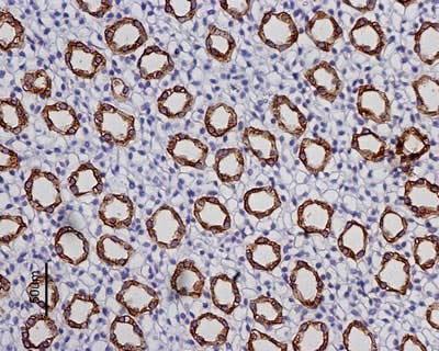 Anti-Aquaporin 2 Antibody