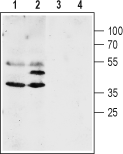 Aquaporin 4/AQP4 (300-314) Blocking Peptide