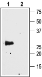 Aquaporin 4/AQP4 (249-323) Blocking Peptide