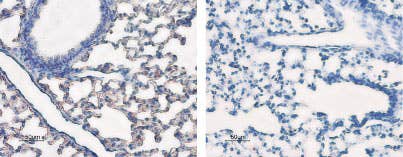 Anti-Aquaporin 5 Antibody