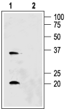 Anti-Aquaporin 6 Antibody