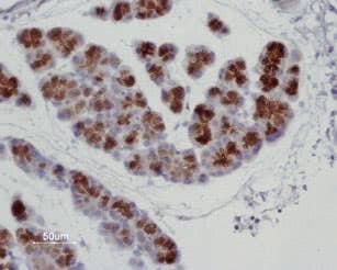 Anti-Aquaporin 8 Antibody