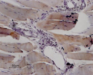 Anti-Ryanodine Receptor 1 Antibody