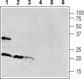 RAMP1 (extracellular) Blocking Peptide