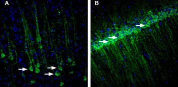 Anti-RAMP1 (extracellular) Antibody