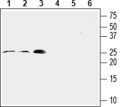 Anti-RAMP2 (extracellular) Antibody