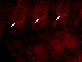 Anti-SCN3A (Na<sub>V</sub>1.3) Antibody