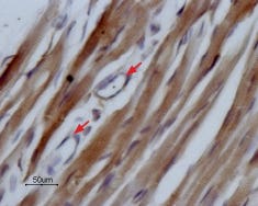 Anti-Na<sub>V</sub>1.5 (SCN5A) (493-511) Antibody
