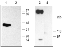 SCN2B/Navβ2 Blocking Peptide