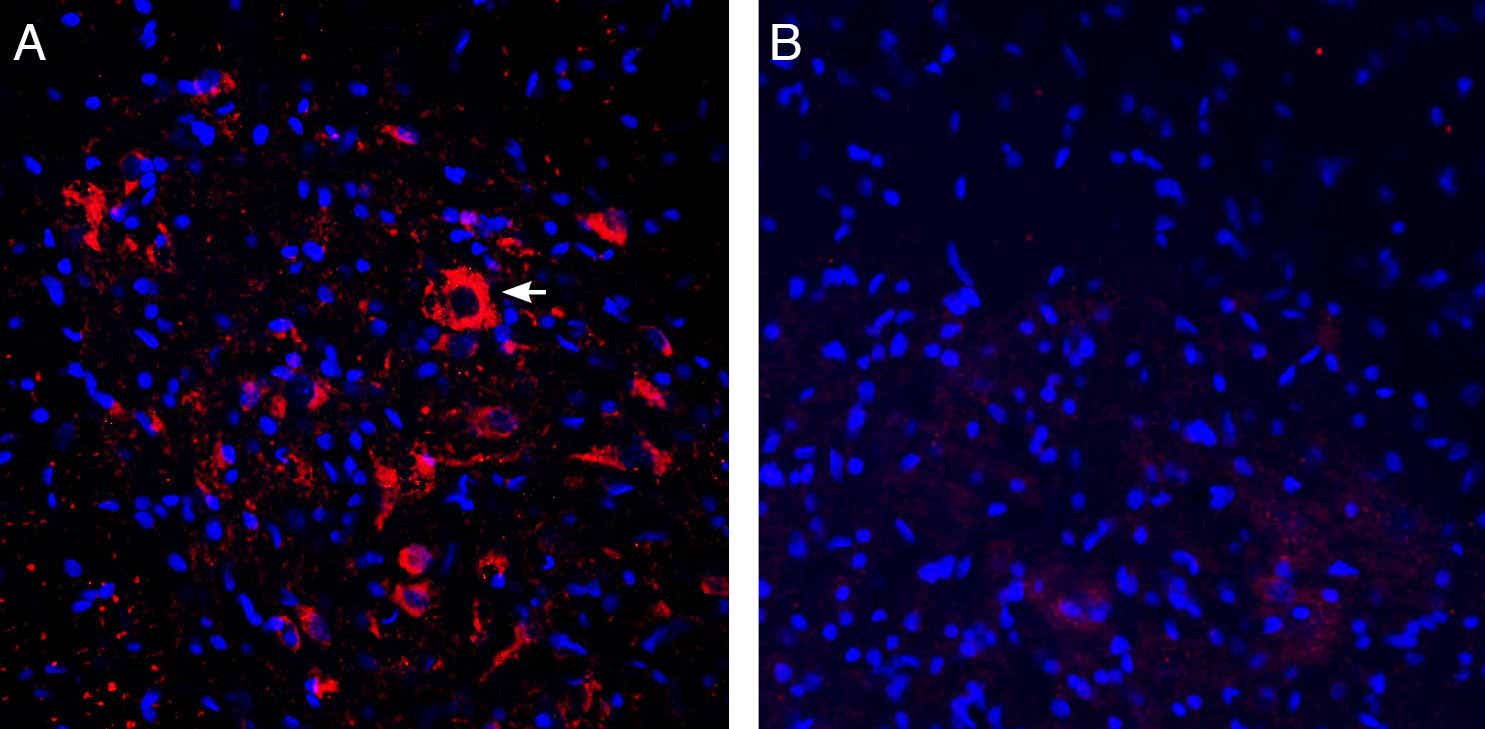 Anti-ASIC2a Antibody