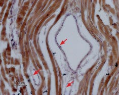 Anti-Na<sub>V</sub>1.5 (SCN5A) (1978-2016) Antibody
