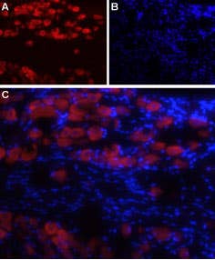 Anti-Na<sub>V</sub>1.8 (SCN10A)-ATTO Fluor-594 Antibody