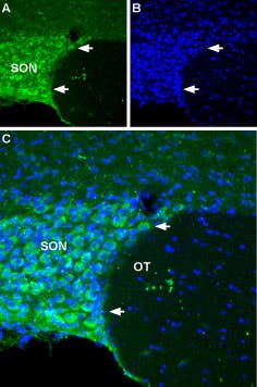 Anti-NALCN/VGCNL1 (extracellular) Antibody
