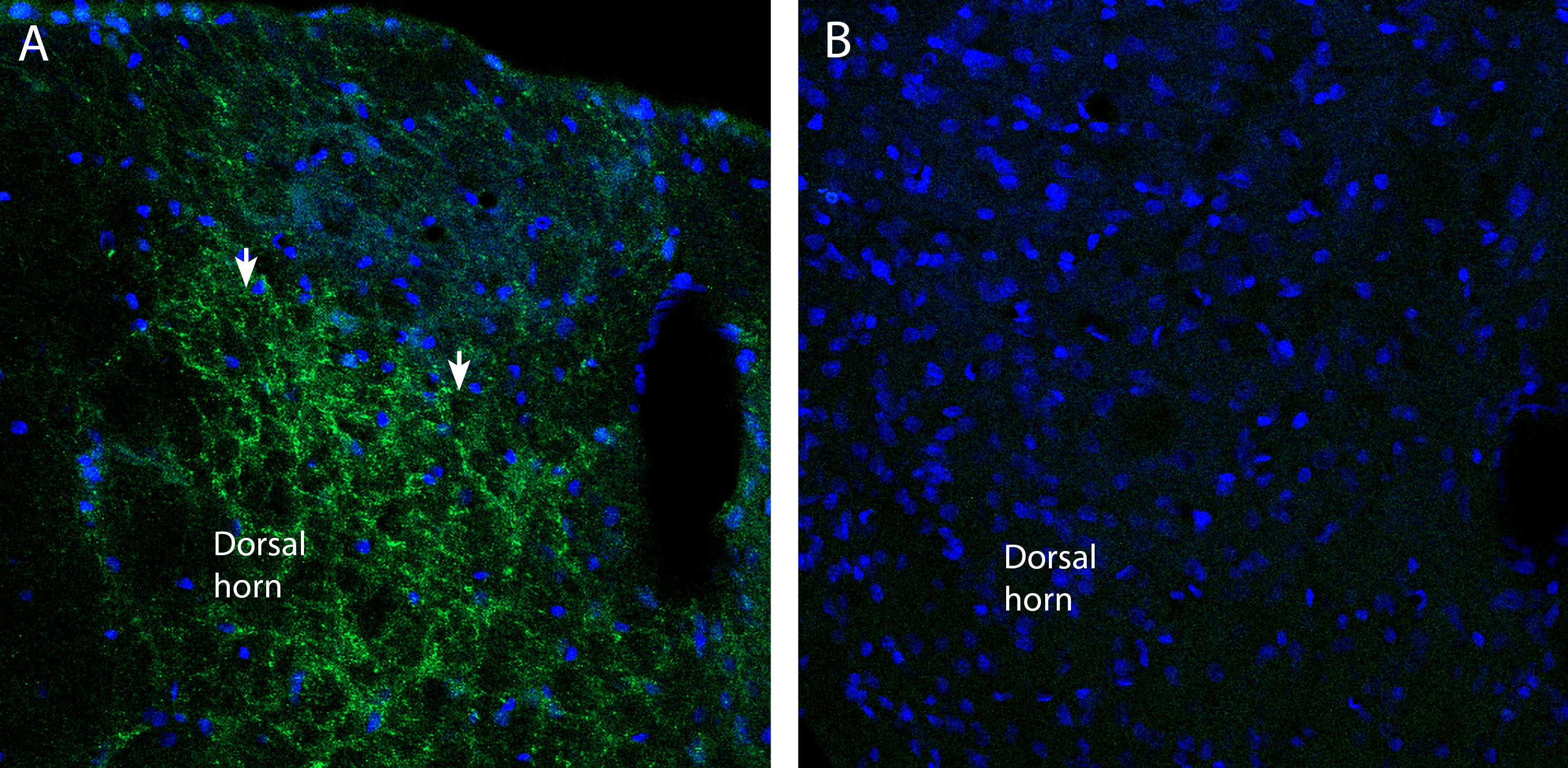 Anti-Na<sub>V</sub>1.7 (SCN9A) (extracellular) Antibody