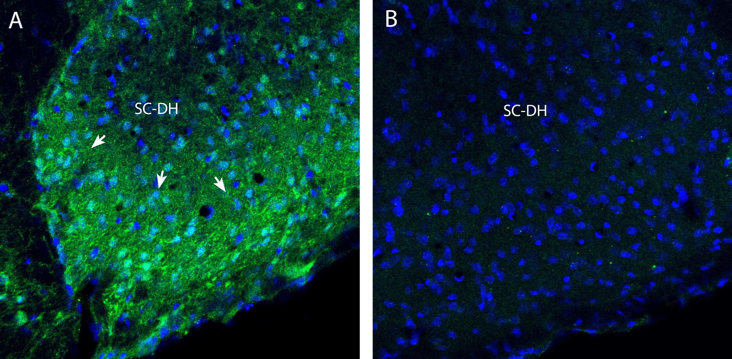 Anti-Na<sub>V</sub>1.8 (SCN10A) (extracellular) Antibody