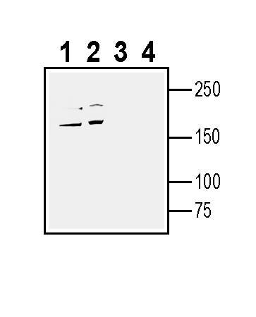 Human NaV1.7 (SCN9A) (extracellular) Blocking Peptide