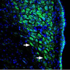 Anti-pan ASIC (extracellular) Antibody