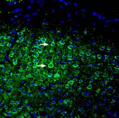 Anti-ASIC5 (extracellular) Antibody