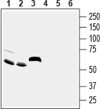 ASIC5 (extracellular) Blocking Peptide