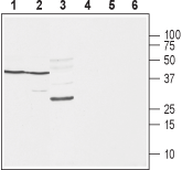 SCN1B/Navβ1 (extracellular) Blocking Peptide