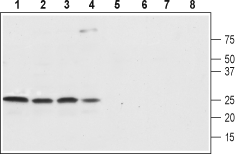 SCN4B/Navβ4 (extracellular) Blocking Peptide