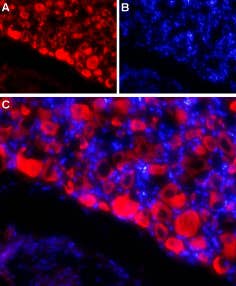 Anti-SCN4B (Na<sub>V</sub>β<sub>4</sub>) (extracellular) Antibody