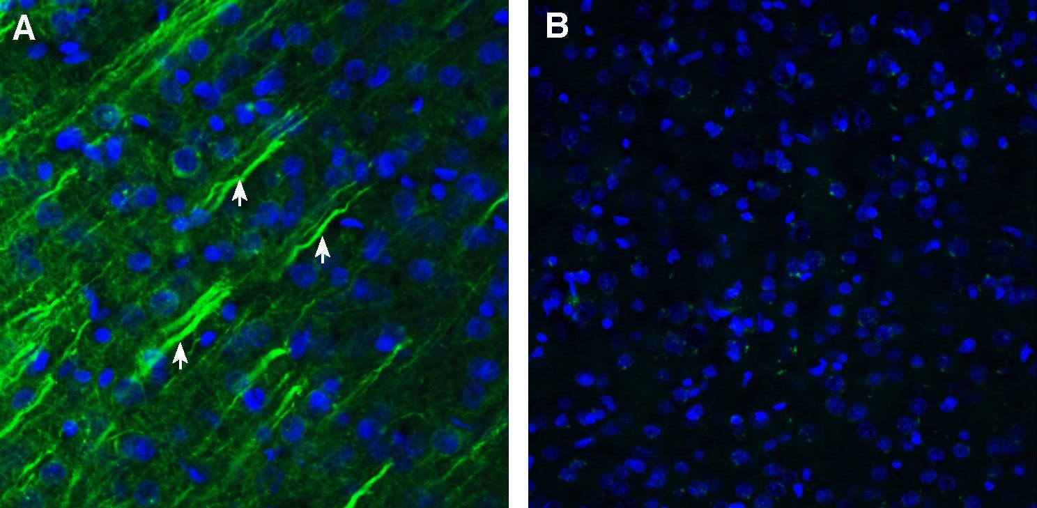 Anti-Somatostatin Receptor Type 1 (extracellular) Antibody