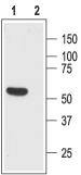 Somatostatin Receptor Type 1 (extracellular) Blocking Peptide