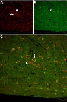 Anti-Somatostatin Receptor Type 3 Antibody