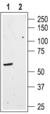 Somatostatin Receptor Type 3 Blocking Peptide