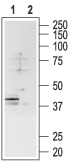 Somatostatin Receptor Type 4 (extracellular) Blocking Peptide