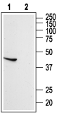 Somatostatin Receptor Type 5 (extracellular) Blocking Peptide