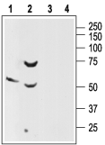 Somatostatin Receptor Type 2 (extracellular) Blocking Peptide