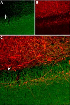 Anti-Somatostatin Receptor Type 2 (extracellular) Antibody