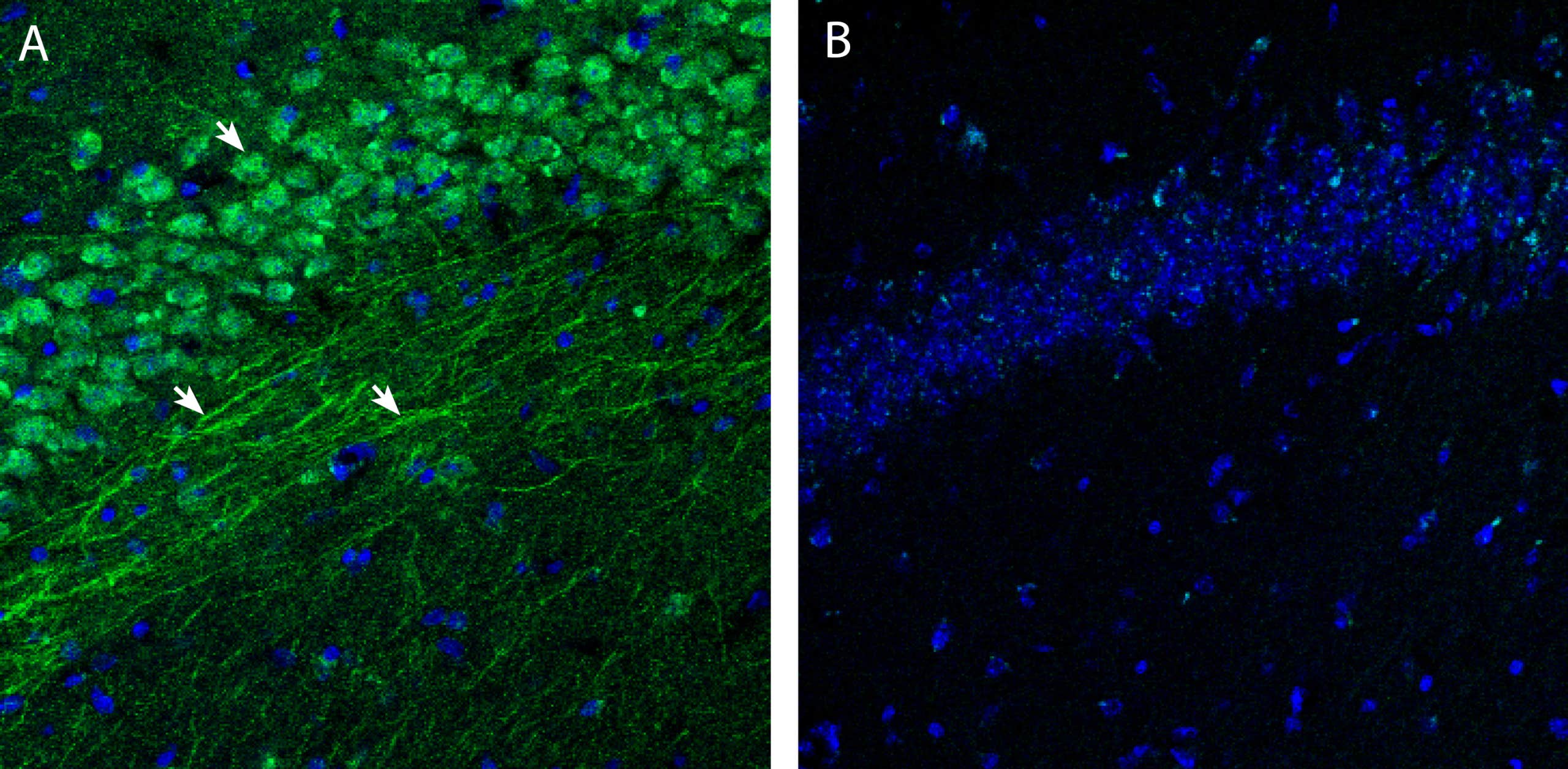 Anti-S1PR3 (EDG3) (extracellular) Antibody
