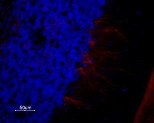 Anti-5HT1A Receptor (HTR1A) Antibody