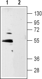 5HT1B Receptor/HTR1B (extracellular) Blocking Peptide