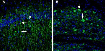 Anti-5HT1B Receptor (HTR1B) (extracellular) Antibody