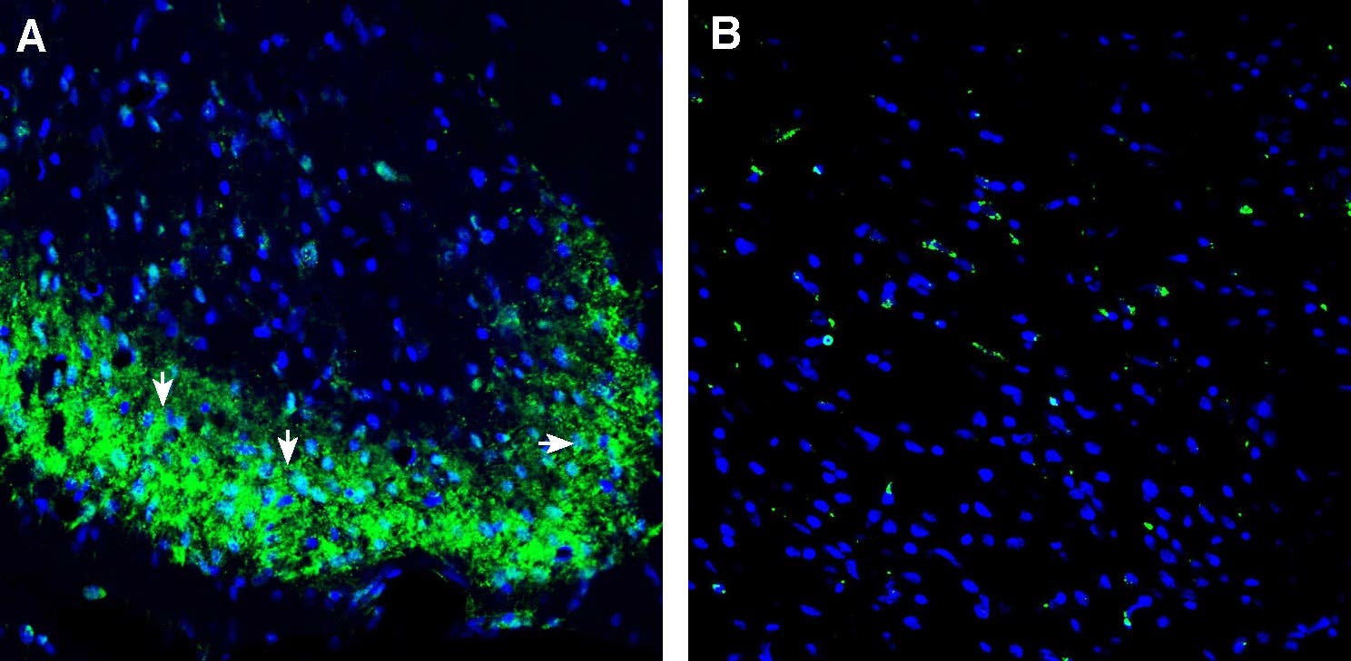 Anti-5HT1D Receptor (HTR1D) (extracellular) Antibody