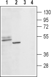 5HT1D Receptor/HTR1D (extracellular) Blocking Peptide