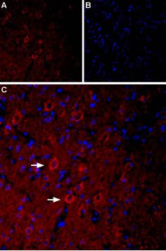 Anti-5HT3A Receptor (HTR3A) Antibody
