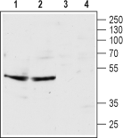 5HT3B Receptor/HTR3B (extracellular) Blocking Peptide