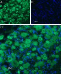 Anti-5HT3B Receptor (HTR3B) (extracellular) Antibody