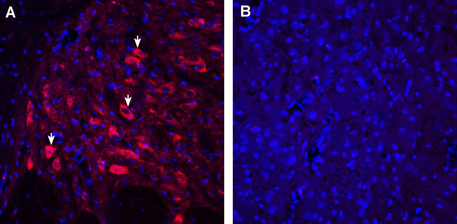 Guinea Pig Anti-5HT2A Receptor (HTR2A) (extracellular) Antibody