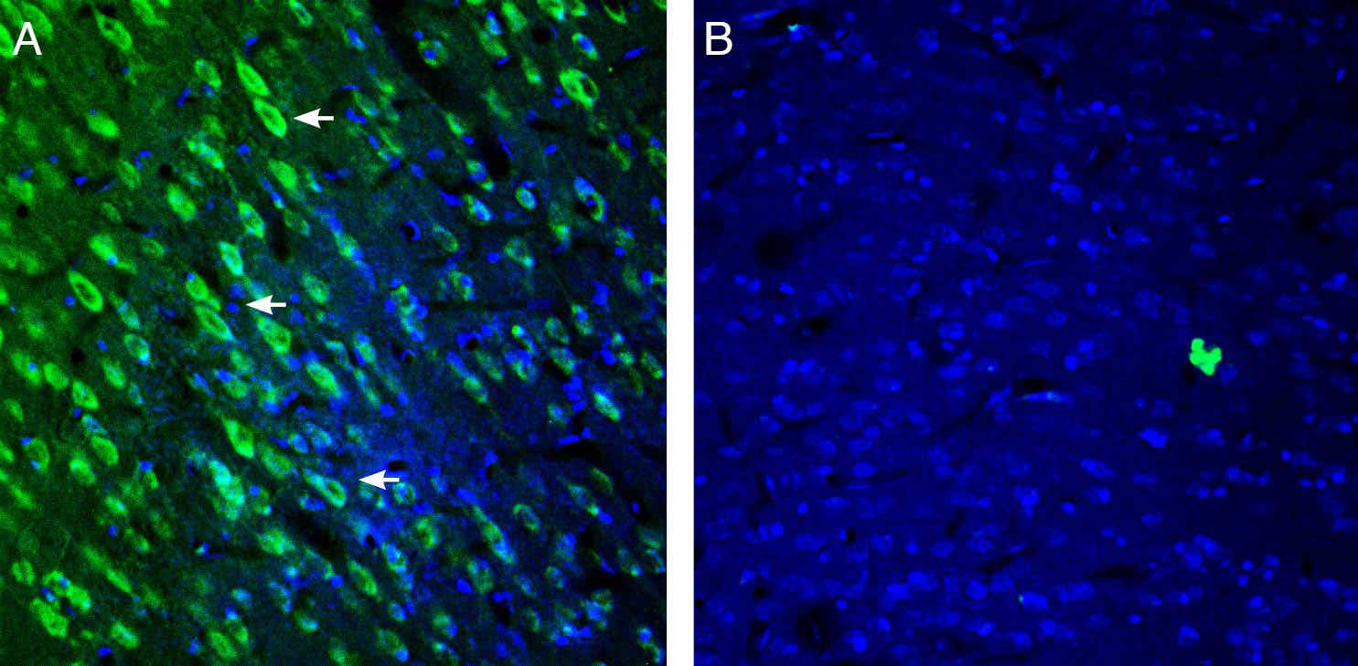 Anti-5HT2A Receptor (HTR2A) (extracellular) Antibody