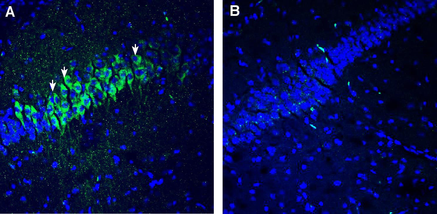 Anti-5HT2C Receptor (HTR2C) Antibody