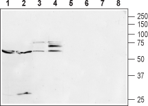 5HT2B Receptor/HTR2B (extracellular) Blocking Peptide