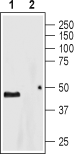5HT4 Receptor/HTR4 (extracellular) Blocking Peptide