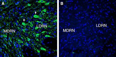 Anti-5HT7 Receptor/HTR7 (extracellular) Antibody